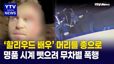 할리우드 한복판서 벌어진 무자비한 폭행..."유명 배우 머리를 권총으로 내려쳐"