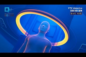 간암 방사선 치료법  I   김민성 내과