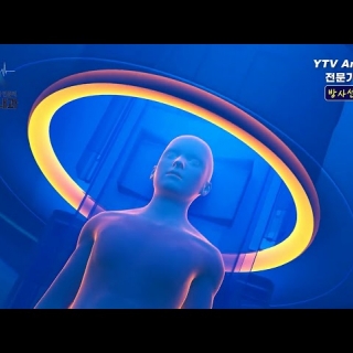 간암 방사선 치료법  I   김민성 내과